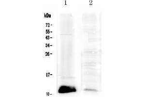 Western blot analysis of Tff1 using anti-Tff1 antibody . (TFF1 antibody  (AA 22-87))