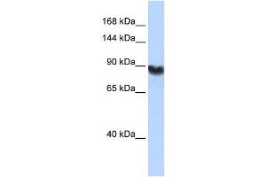 LIG1 antibody used at 1 ug/ml to detect target protein. (LIG1 antibody  (Middle Region))