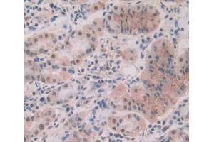 Used in DAB staining on fromalin fixed paraffin- embedded stomach tissue (PPP1CA antibody  (AA 2-330))