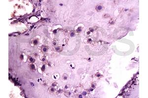 Formalin-fixed and paraffin embedded human placenta tissue labeled with Anti-GLP-1R Polyclonal Antibody, unconjugated (ABIN731333) at 1: 200 followed by incubation with conjugated secondary antibody and DAB staining (GLP1R antibody  (AA 101-200))