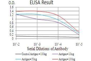 Black line: Control Antigen (100 ng), Purple line: Antigen(10 ng), Blue line: Antigen (50 ng), Red line: Antigen (100 ng), (CBX4 antibody  (AA 397-514))