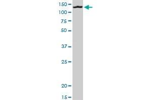 MORC1 antibody  (AA 1-100)