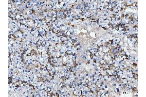 IHC analysis of CD14 using anti-CD14 antibody (ABIN7600531). (CD14 antibody  (AA 20-259))