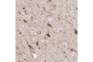 Immunohistochemical staining of human cerebral cortex with GLDC polyclonal antibody  shows strong cytoplasmic positivity in neuronal cells. (GLDC antibody)