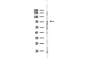 Western blot analysis of lysates from 293 cells(UV 30 min treatment), using ACCN2 Antibody at 1/1000 dilution.