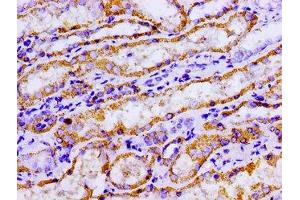 Immunohistochemistry of paraffin-embedded human kidney tissue using ABIN7143021 at dilution of 1:100 (ACO2 antibody  (AA 452-676))