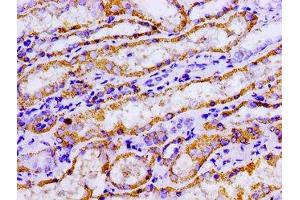 Immunohistochemistry of paraffin-embedded human kidney tissue using ABIN7143021 at dilution of 1:100