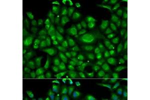Immunofluorescence analysis of U2OS cells using HSPA1L Polyclonal Antibody (HSPA1L antibody)