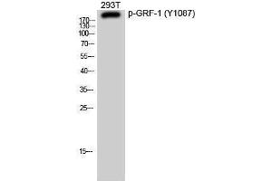 Western Blotting (WB) image for anti-Glucocorticoid Receptor DNA Binding Factor 1 (GRLF1) (pTyr1087) antibody (ABIN3182020) (GRLF1 antibody  (pTyr1087))