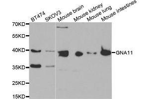 Western blot analysis of extracts of various cell lines, using GNA11 antibody. (GNA11 antibody)