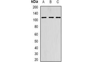 Western blot analysis of AARS2 expression in HepG2 (A), SKOV3 (B), MCF7 (C) whole cell lysates. (AARS2 antibody)