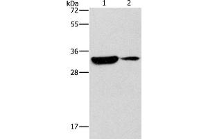 Western Blot analysis of Mouse heart and brain tissue using DSCR1 Polyclonal Antibody at dilution of 1:500 (RCAN1 antibody)