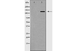 Western blot analysis of ZEB2 expression in HepG2 cell lysate,The lane on the left is treated with the antigen-specific peptide. (ZEB2 antibody  (N-Term))