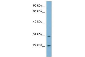 HSD17B14 antibody used at 1 ug/ml to detect target protein.