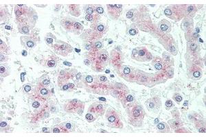 Immunohistochemistry (IHC) image for anti-Complement Component 5a (C5a) (AA 678-751) antibody (ABIN7442321)