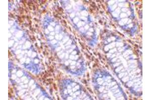 Immunohistochemistry of HTRA2 in human colon tissue with HTRA2 polyclonal antibody  at 10 ug/mL . (HTRA2 antibody  (C-Term))