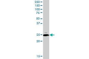 ARHGDIA MaxPab rabbit polyclonal antibody. (ARHGDIA antibody  (AA 1-204))