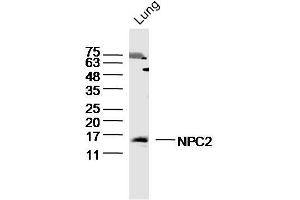 Mouse Lung lysates probed with NPC2 Polyclonal Antibody, Unconjugated  at 1:300 dilution and 4˚C overnight incubation. (NPC2 antibody  (AA 20-80))
