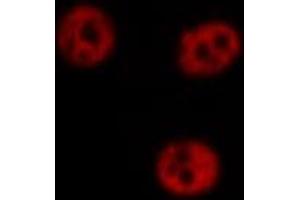 ABIN6266711 staining Hela by IF/ICC. (AKAP8 antibody  (Internal Region))