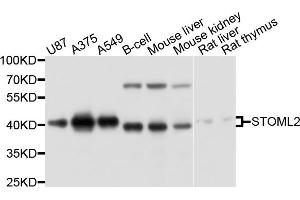 Western blot analysis of extracts of various cell lines, using STOML2 antibody. (STOML2 antibody)