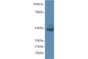 Detection of CD72 in Rat Spleen lysate using Polyclonal Antibody to Cluster Of Differentiation 72 (CD72) (CD72 antibody  (AA 126-237))