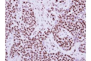 Immunohistochemistry (IHC) image for anti-Tripartite Motif Containing 28 (TRIM28) antibody (ABIN2855331)
