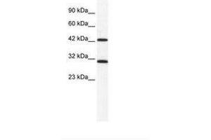 Image no. 1 for anti-DEAD (Asp-Glu-Ala-Asp) Box Polypeptide 39A (DDX39) (N-Term) antibody (ABIN203128)