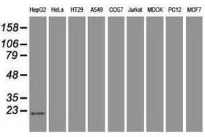 Image no. 2 for anti-Adenylate Kinase 1 (AK1) antibody (ABIN1496517) (Adenylate Kinase 1 antibody)