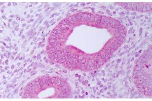 Anti-PDIA3 / ERp57 antibody IHC staining of human uterus, endometrium. (PDIA3 antibody)