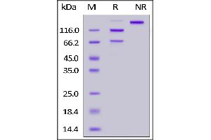 Human Complement C5 (R885H), His Tag on  under reducing (R) and ing (NR) conditions. (C5 Protein (AA 19-1676) (His tag))