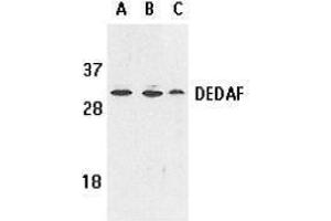 Western Blotting (WB) image for anti-RING1 and YY1 Binding Protein (RYBP) (AA 215-228) antibody (ABIN2473292) (RYBP antibody  (AA 215-228))