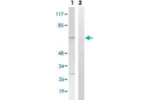 Western blot analysis of Lane 1: Untreated K562 cell lysates, Lane 2: Synthesized peptide treated K562 cell lysates reacted with BLNK (phospho Y84) polyclonal antibody  at 1:500-1:3000 dilution. (B-Cell Linker antibody  (pTyr84))
