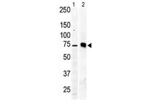 Western blot testing of PKC beta 2 antibody and Jurkat cell lysate (lane 1) and mouse brain tissue lysate (2). (PKC beta antibody  (AA 642-673))