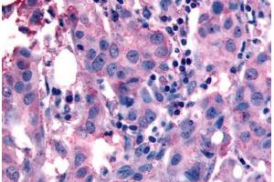 NANP antibody  (Internal Region)