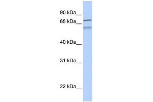 WB Suggested Anti-ZNF671 Antibody Titration:  0.