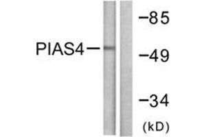 Western blot analysis of extracts from Jurkat cells, using PIAS4 Antibody. (PIAS4 antibody  (AA 451-500))