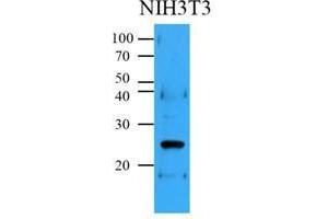 Cell lysates (35 ug) were resolved by SDS-PAGE, transferred to PVDF membrane and probed with anti-human Bcl-2 (1:500). (Bcl-2 antibody  (AA 1-211))