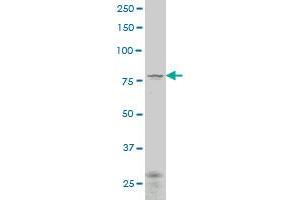 TGM7 polyclonal antibody (A01), Lot # 060717JCS1 Western Blot analysis of TGM7 expression in Y-79 . (Transglutaminase 7 antibody  (AA 466-565))