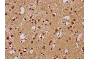 IHC image of ABIN7165594 diluted at 1:300 and staining in paraffin-embedded human brain tissue performed on a Leica BondTM system. (FEV antibody  (AA 1-97))