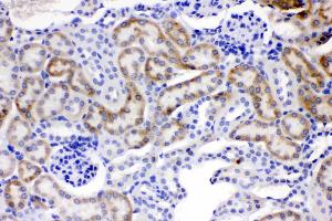 ACSL1 was detected in paraffin-embedded sections of mouse kidney tissues using rabbit anti- ACSL1 Antigen Affinity purified polyclonal antibody (Catalog # ) at 1 µg/mL. (ACSL1 antibody  (AA 604-698))