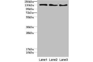 Western blot All lanes: RBP2antibody at 1. (RBP2 antibody  (AA 1-134))