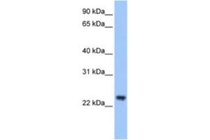Western Blotting (WB) image for anti-Tripartite Motif Containing 48 (TRIM48) antibody (ABIN2463447) (TRIM48 antibody)