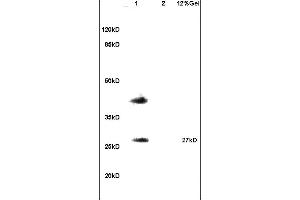 Lane 1: mouse testis lysates Lane 2: mouse brain lysates probed with Anti RSPO1 Polyclonal Antibody, Unconjugated (ABIN715451) at 1:200 in 4 °C. (RSPO1 antibody)