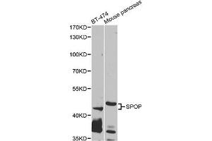 Western blot analysis of extracts of various cell lines, using SPOP antibody (ABIN5995544) at 1/1000 dilution.