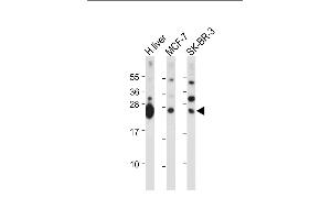All lanes : Anti-GSTM4 Antibody (N-term) at 1:2000 dilution Lane 1: Human liver tissue lysate Lane 2: MCF-7 whole cell lysate Lane 3: SK-BR-3 whole cell lysate Lysates/proteins at 20 μg per lane. (GSTM4 antibody  (N-Term))
