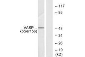 Western blot analysis of extracts from NIH-3T3 cells treated with forskolin 40 muM 30', using VASP (Phospho-Ser157) Antibody. (VASP antibody  (pSer157))