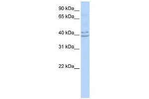PYHIN1 antibody used at 0. (PYHIN1 antibody  (N-Term))
