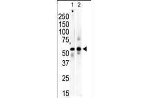 Western blot analysis of anti-PI4K II beta Pab in mouse brain (Lane A) and Saos-2 (Lane B) cell lysate. (PI4K2B antibody  (C-Term))