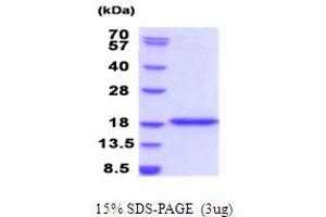 SDS-PAGE (SDS) image for Bromodomain Containing 1 (BRD1) (AA 556-688) protein (His tag) (ABIN5853949) (BRD1 Protein (AA 556-688) (His tag))