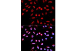 Immunofluorescence analysis of U2OS cells using PPP1CA antibody. (PPP1CA antibody)